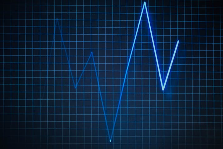 How to Disable ECG on Your Apple Watch 2 How to Disable ECG on Your Apple Watch 1
