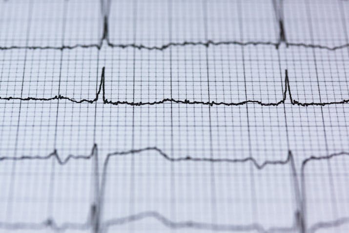 How to Disable ECG on Your Apple Watch 4 How to Disable ECG on Your Apple Watch 3