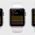How Dexcom G6 Direct Brings CGM to Your Apple Watch 14 How Dexcom G6 Direct Brings CGM to Your Apple Watch 13