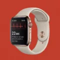 Troubleshooting ECG App Not Working on Your Apple Watch 4 10 Troubleshooting ECG App Not Working on Your Apple Watch 4 9