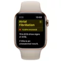 How to Disable ECG on Your Apple Watch 15