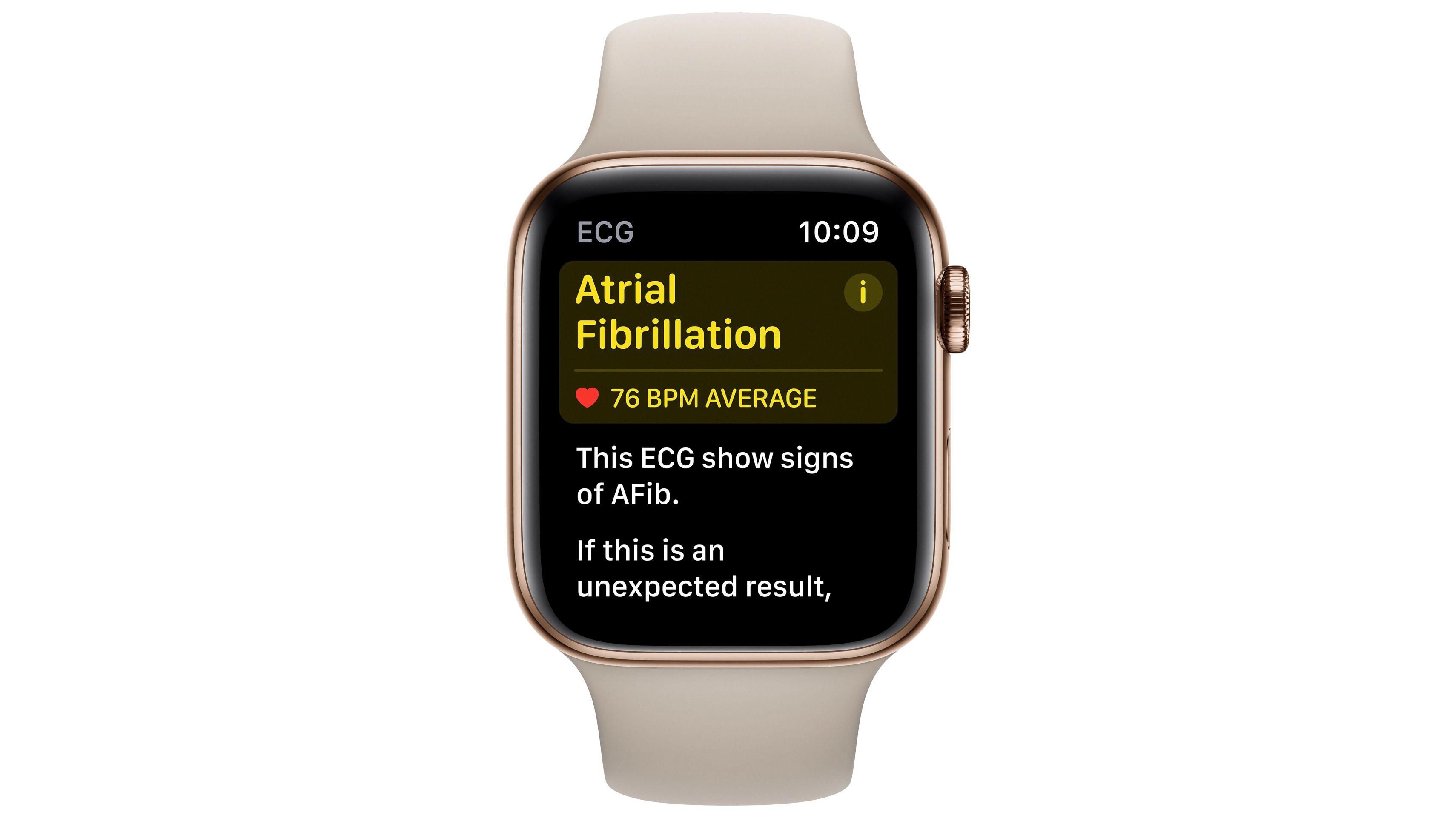 How to Disable ECG on Your Apple Watch 3