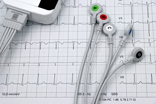 Why is My Heart Monitor Flashing Green? 9