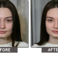 How to Remove Imperfections From Photos? 16 How to Remove Imperfections From Photos? 15
