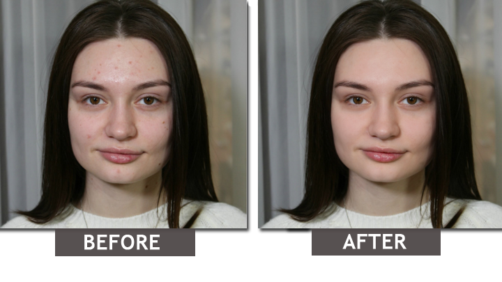 How to Remove Imperfections From Photos? 1