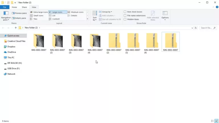 How to Extract Multiple Zip Files at Once? 9