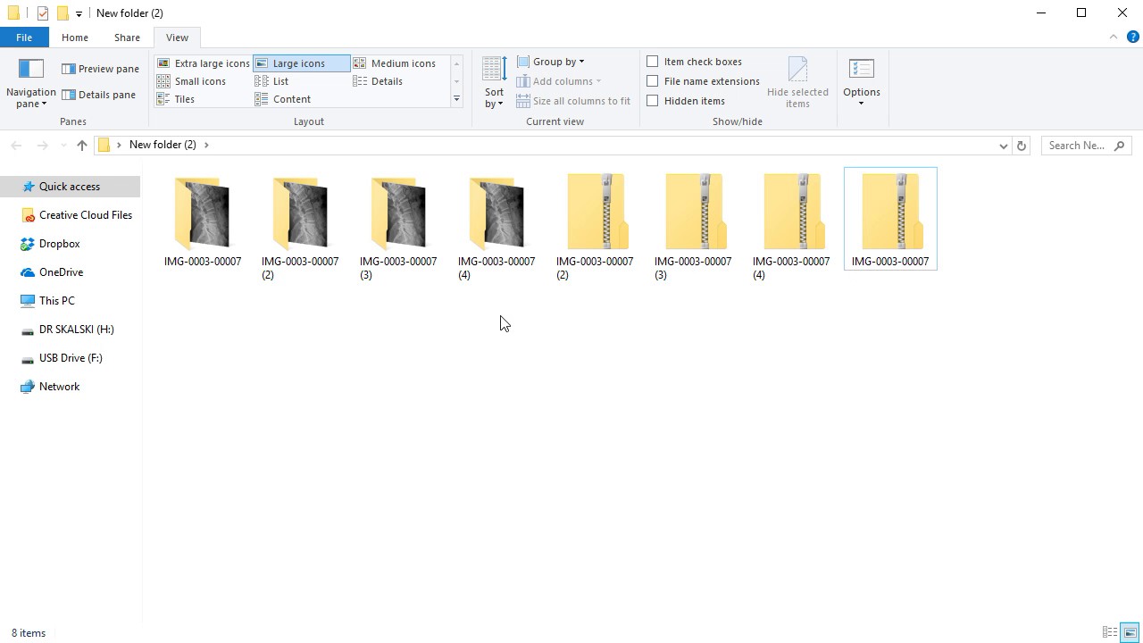 How to Extract Multiple Zip Files at Once? 1